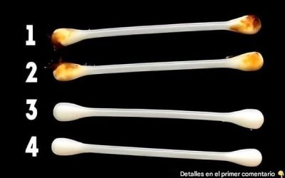 Si el cerumen de tus oídos es de este color, entonces… Ver más 👇