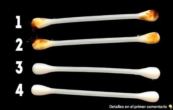 Si el cerumen de tus oídos es de este color, entonces… Ver más 👇