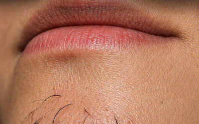 ¿Por qué algunas mujeres se tienen vello facial? Causas y soluciones
