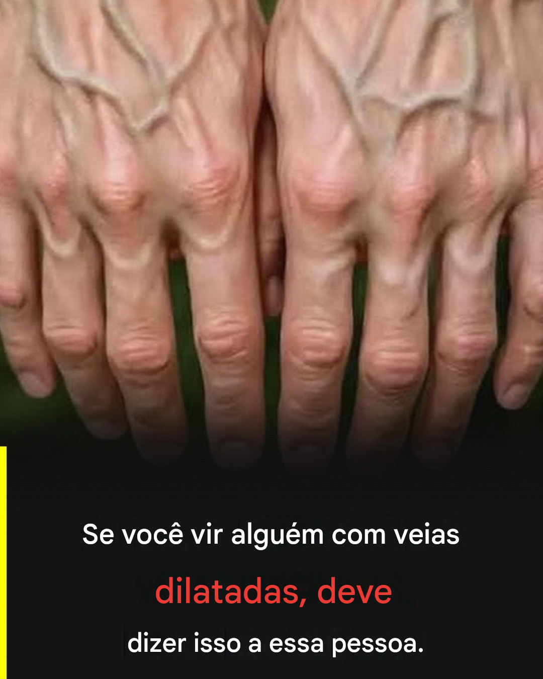 Por que suas veias parecem mais proeminentes: sinais do corpo que você deve entender.