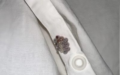Encontré estas pequeñas canicas en mi cama y casi me da infarto: os voy a contar lo que eran.