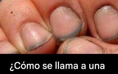 ¿Cómo se llama a una persona que tiene las uñas así?
