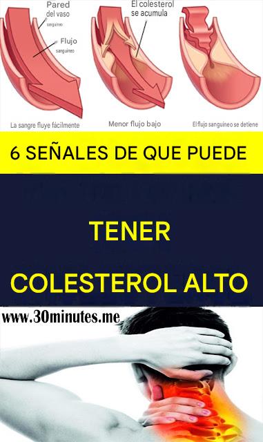 6 señales de que podrías tener el colesterol alto