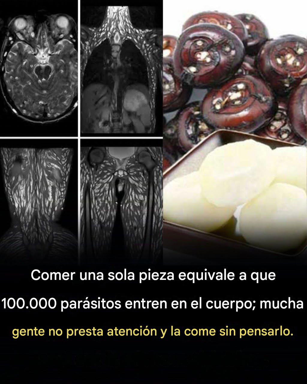 Comer tan solo un bocado puede ser perjudicial: cómo protegerse de los parásitos transmitidos por los alimentos.