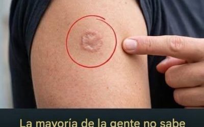 Cicatriz redonda en el brazo: ¿qué significa?