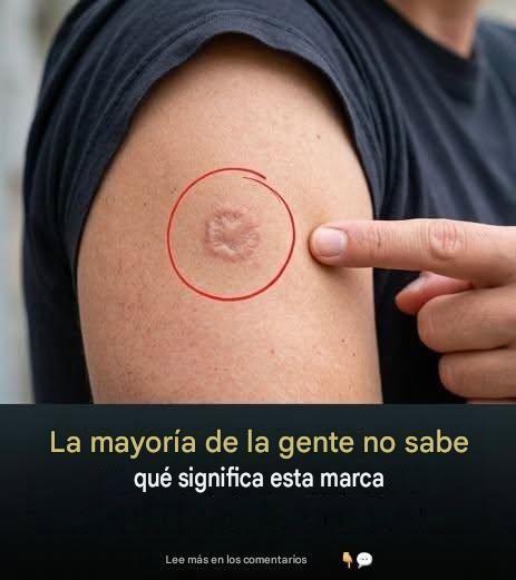 Cicatriz redonda en el brazo: ¿qué significa?