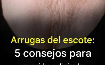 Arrugas en el escote: 5 consejos para prevenirlas y eliminarlas
