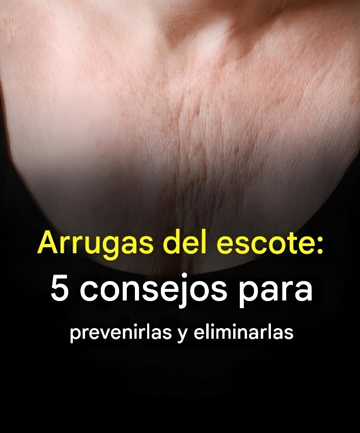 Arrugas en el escote: 5 consejos para prevenirlas y eliminarlas