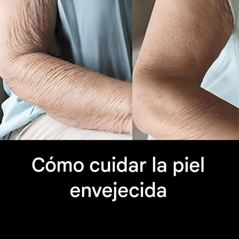 Cómo cuidar la piel envejecida