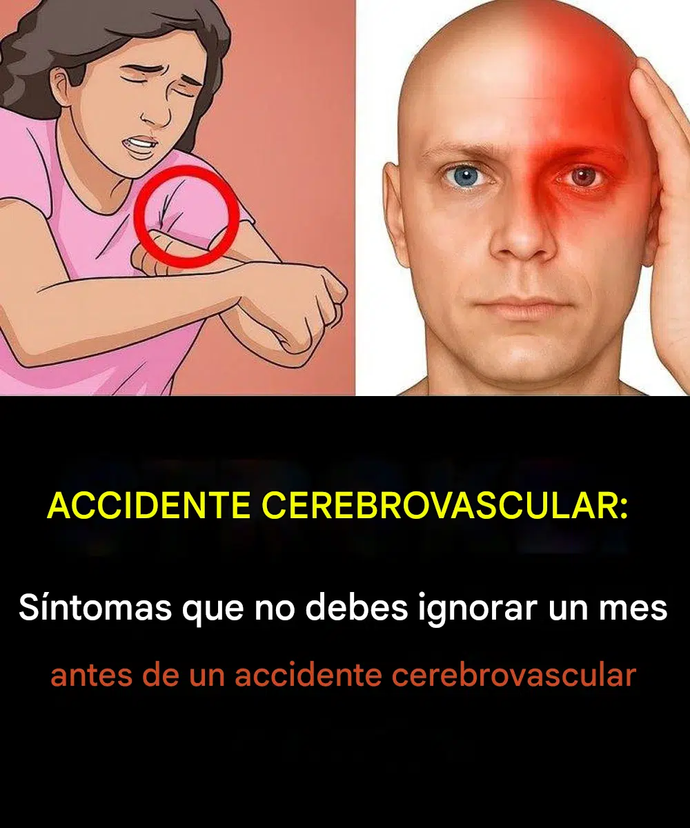 UN MES ANTES DE UN ACCIDENTE CEREBROVASCULAR, TU CUERPO PUEDE ENVIAR ESTAS SEÑALES DE ALERTA, Y PUEDEN SER DIFERENTES PARA HOMBRES Y MUJERES.
