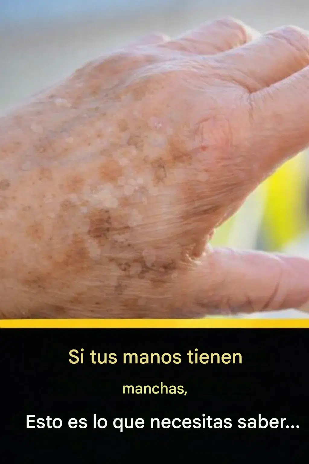 🤔Si aparecen esas manchas en tus manos, es una clara señal de que…👇